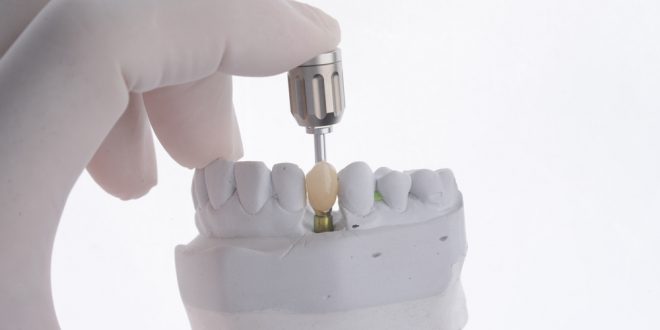 What are dental implant types